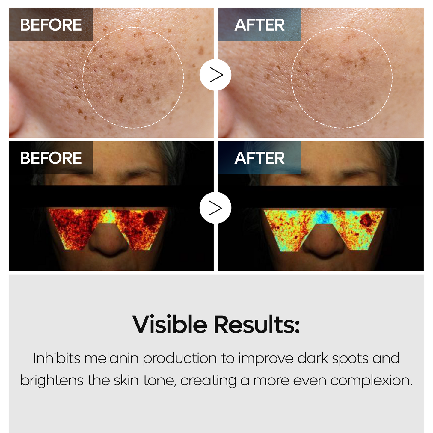 TX Tranexamic Acid Dark Spot Tone Care Line