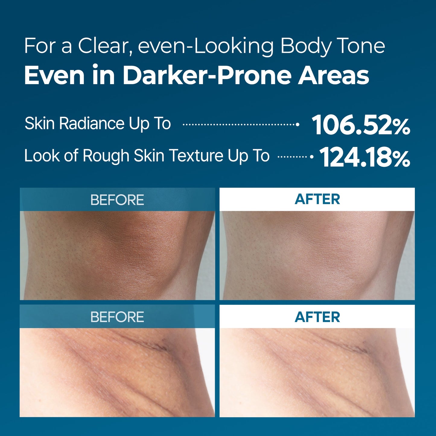 Peel Shot Exfoliating TX Spray